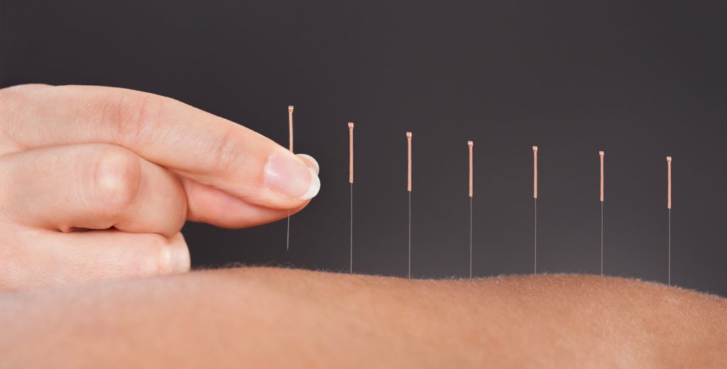 Những điều cần biết về Y Học cổ truyền